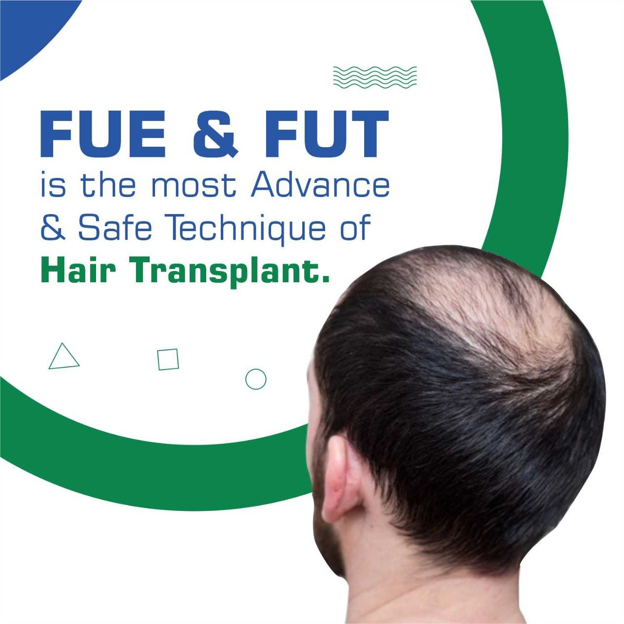 HAIR TRANSPLANT